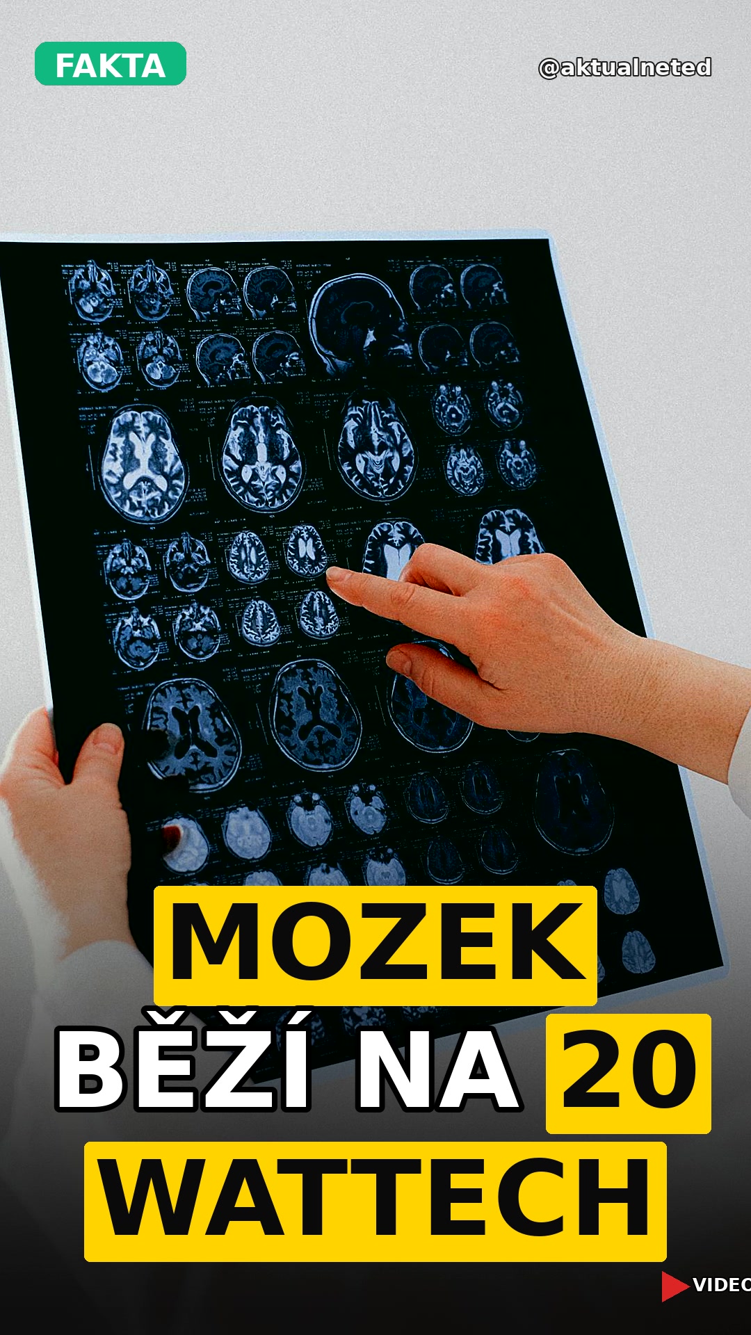 MOZEK BĚŽÍ NA 20 WATTECH